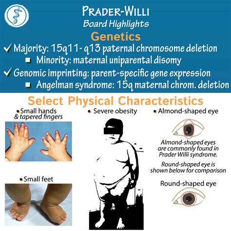 prada willis syndrom|is prader willi syndrome inherited.